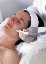 microdermabrasion acne